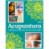 Acupuntura: O poder das agulhas no alívio das dores